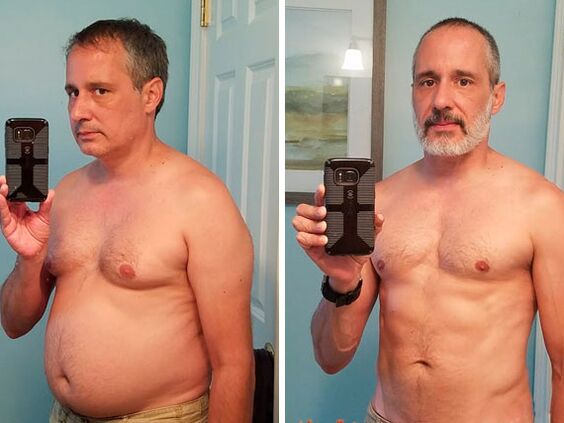 Antes e depois do tratamento com gotas Alcozar